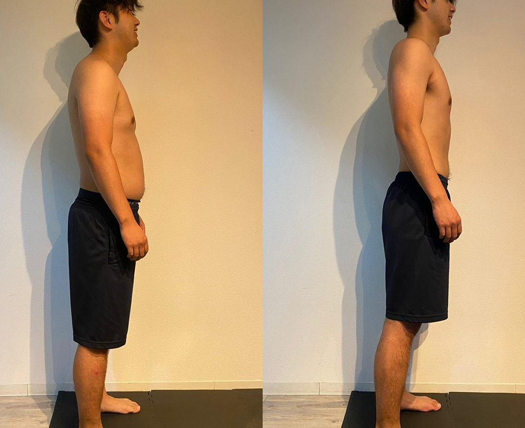 ビフォーアフター・お客様感想｜30代男性の変化の写真